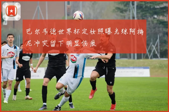 巴尔韦德世界杯定妆照曝光琼阿梅尼冲突留下明显伤痕